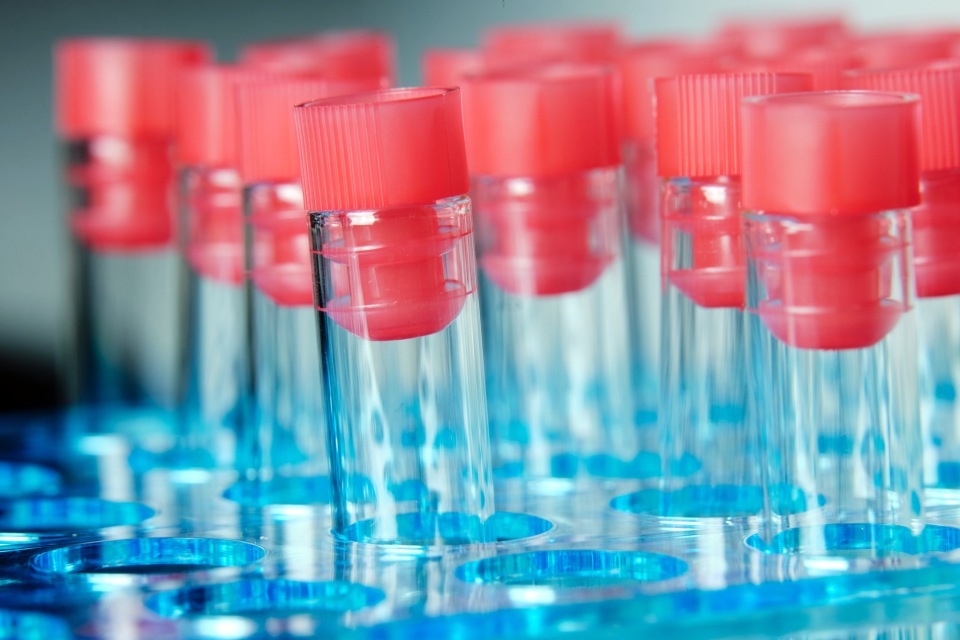 Test na sepsę i COVID-19