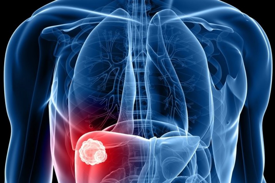 wirusowe zapalenie wątroby